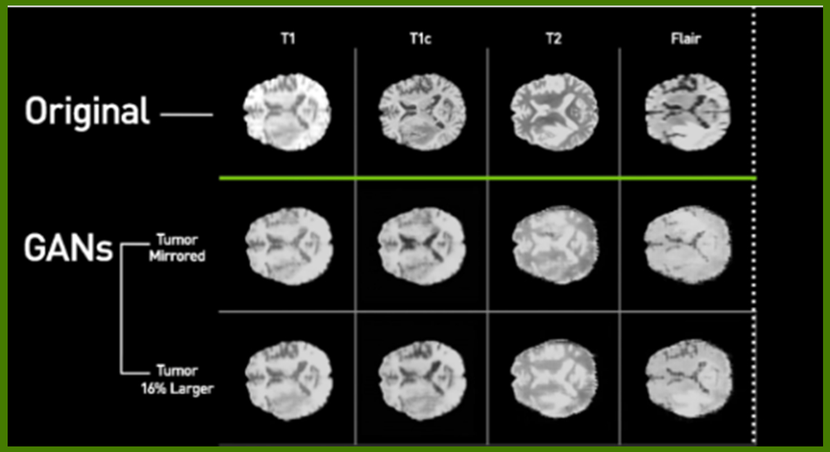 Artifical Brain MRI images